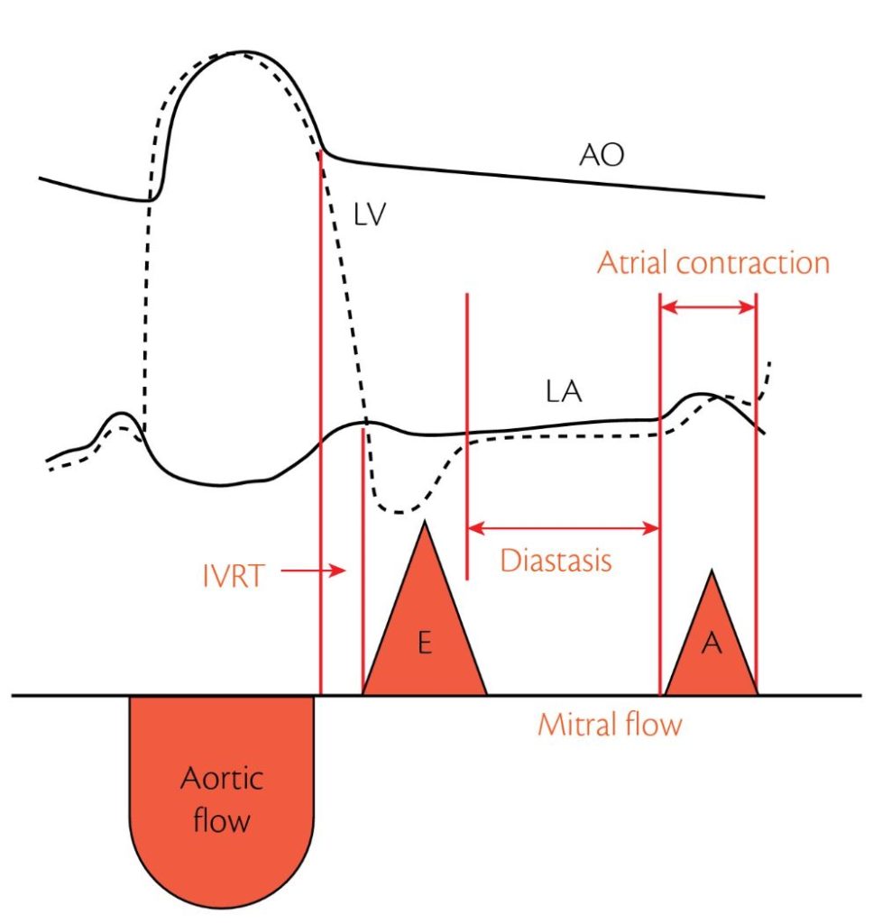 Diastole Cardioplaner